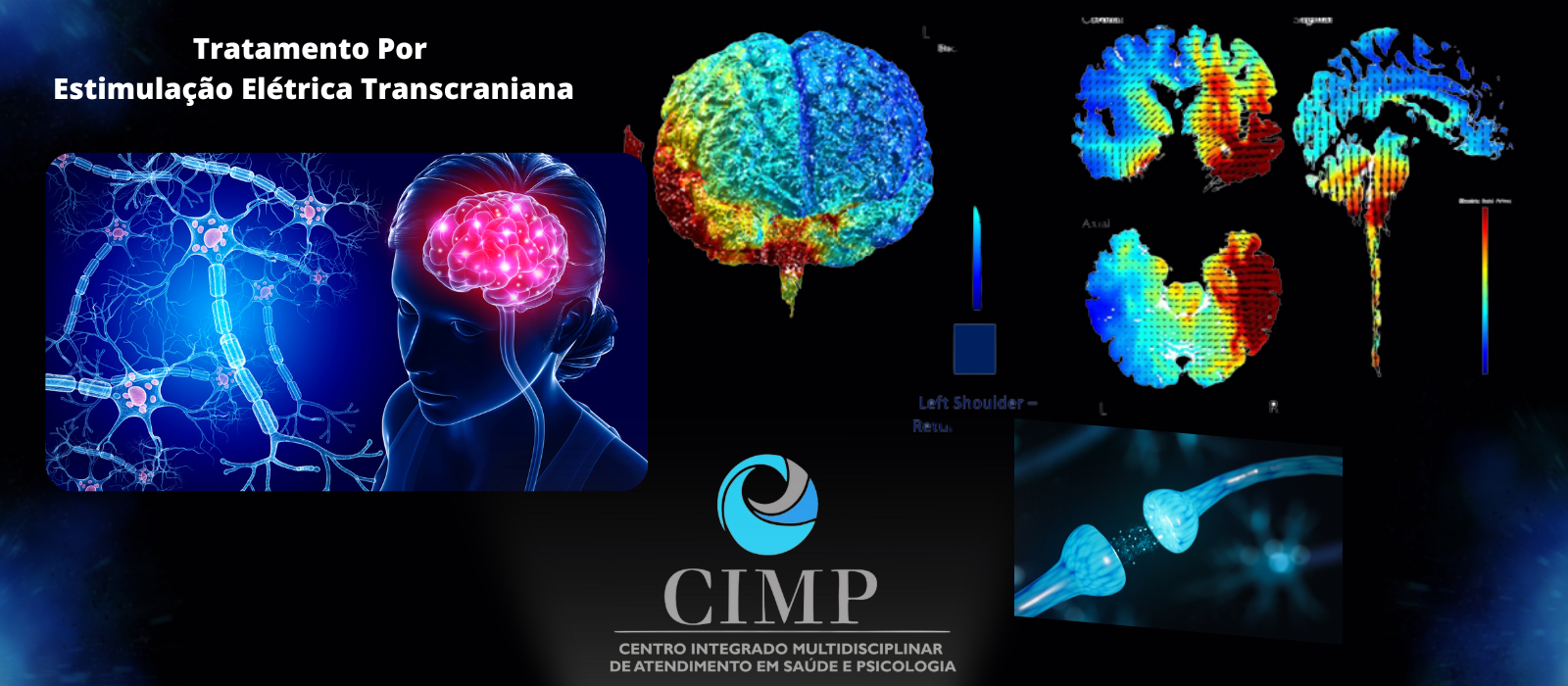 Estimulação elétrica transcraniana TDCs referencia em tratamento em Minas Gerais