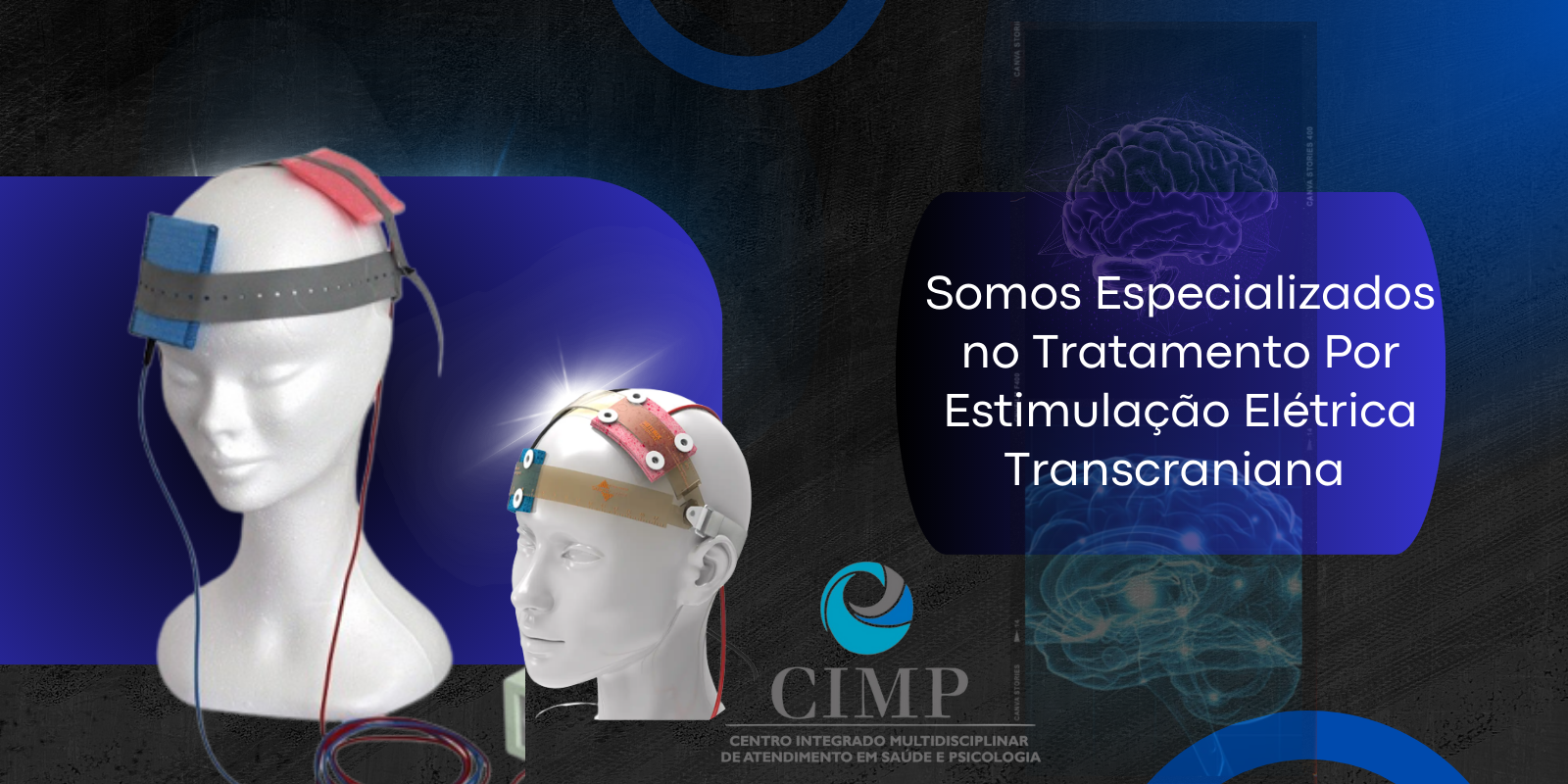 Somos Especializados no Tratamento Por Estimulação Elétrica Transcraniana melhor tratamento de bh