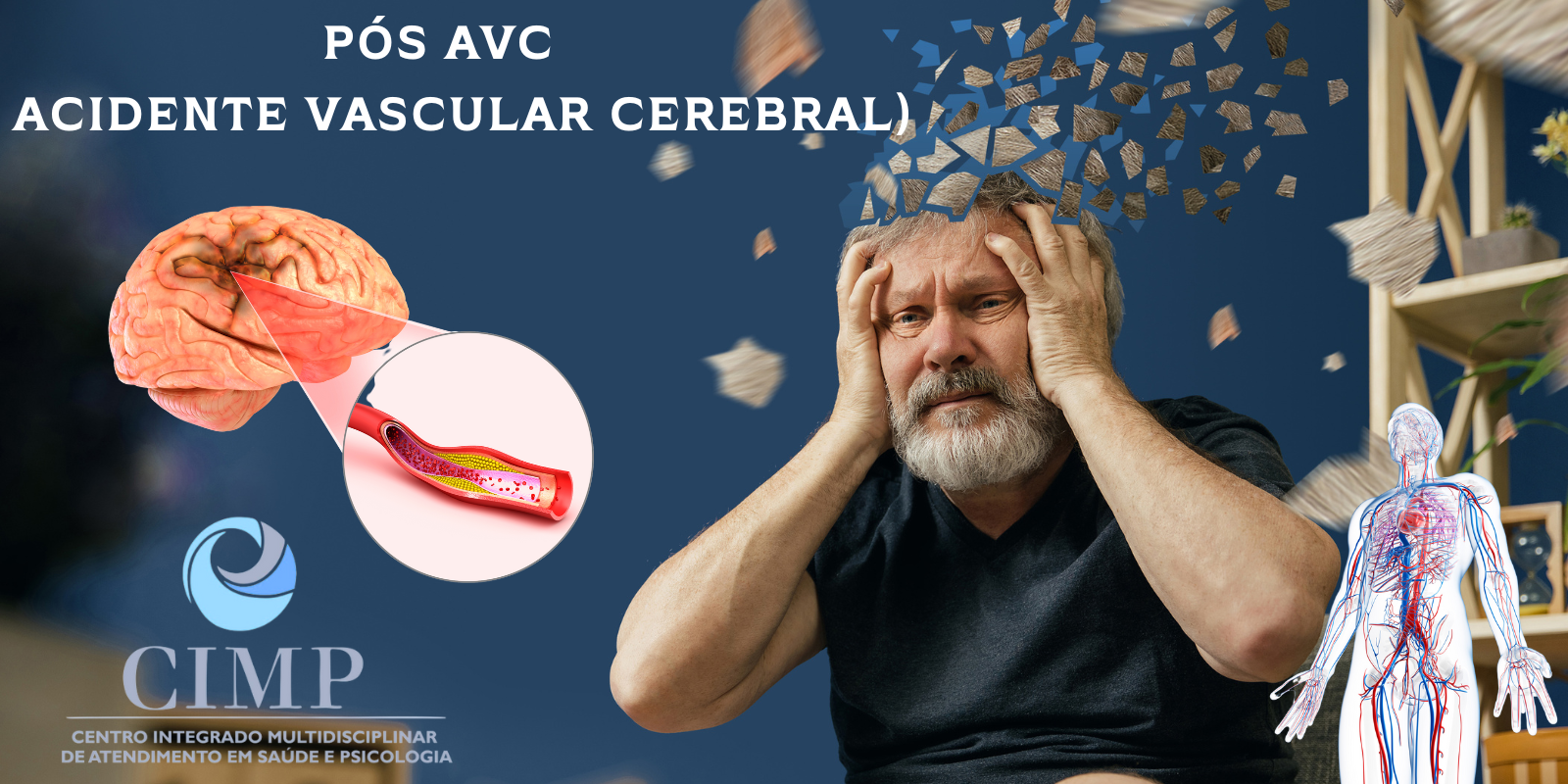 tratamento por eletroestimulação transcraniana – Pós AVC ou AVE ( Acidente Vascular Cerebral)